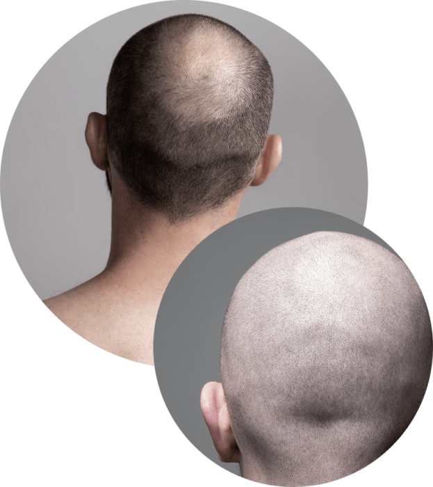 Effetto Rasato