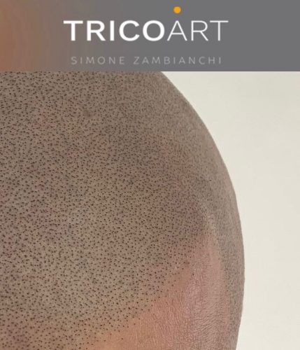 Tricopigmentazione whatsapp image at