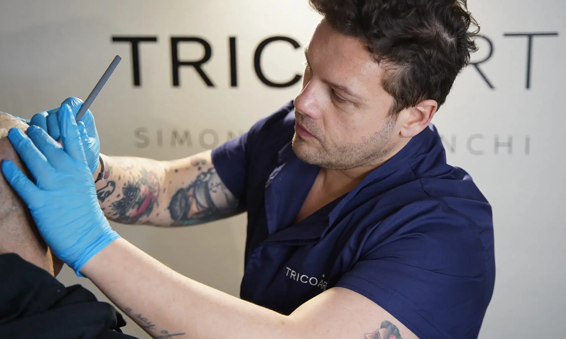 RIMEDI ALL’ALOPECIA: LA TRICOPIGMENTAZIONE A MILANO