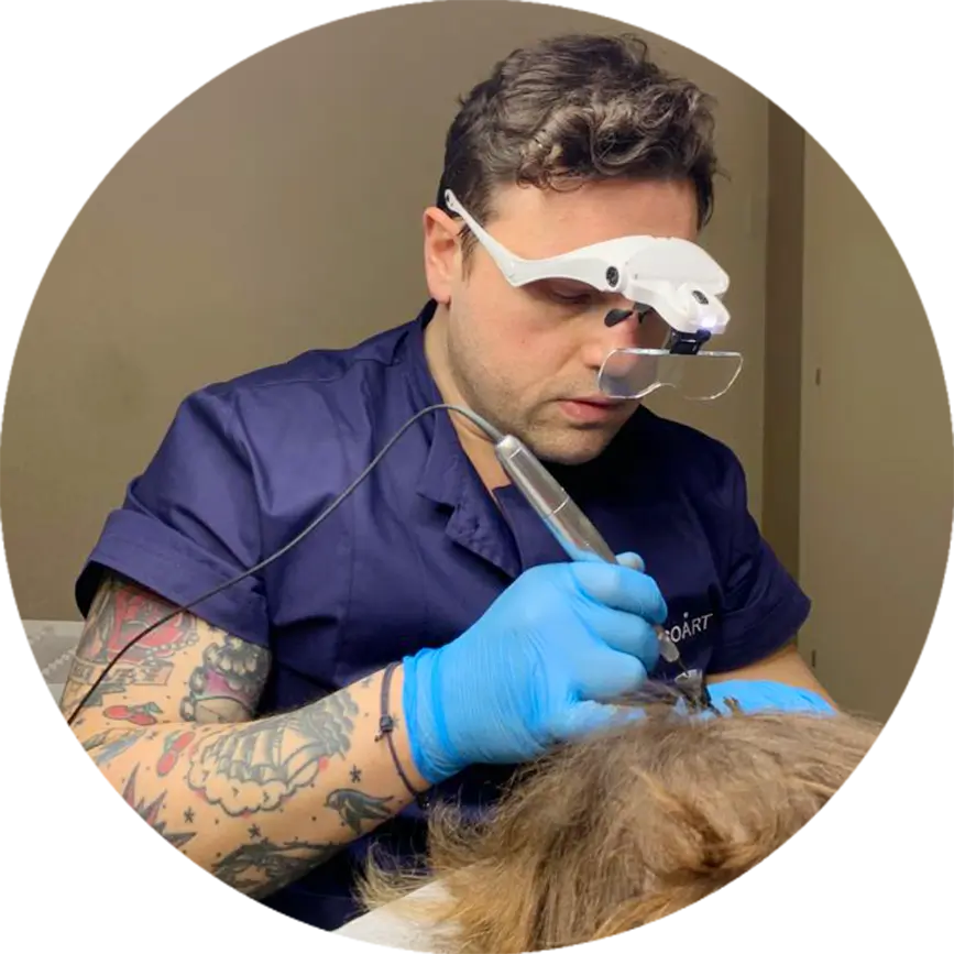 TRAPIANTO DI CAPELLI A PADOVA: LA TRICOPIGMENTAZIONE COME ALTERNATIVA